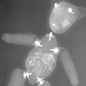 Figure 2b