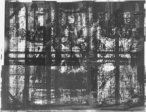 The Healing of the Lame Man – X-ray photograph