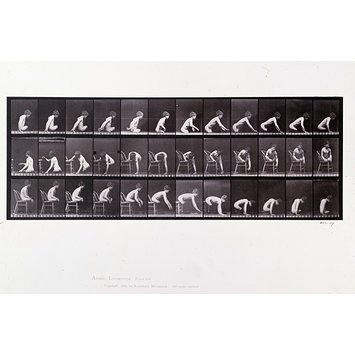 Photograph - Double amputation of thighs; boy Photograph - Double amputation of thighs; boy